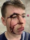 Victim of Garda Brutality Victim of Garda Brutality